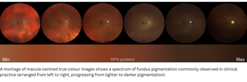 A Montage Of Macula Centred True Colour Images 