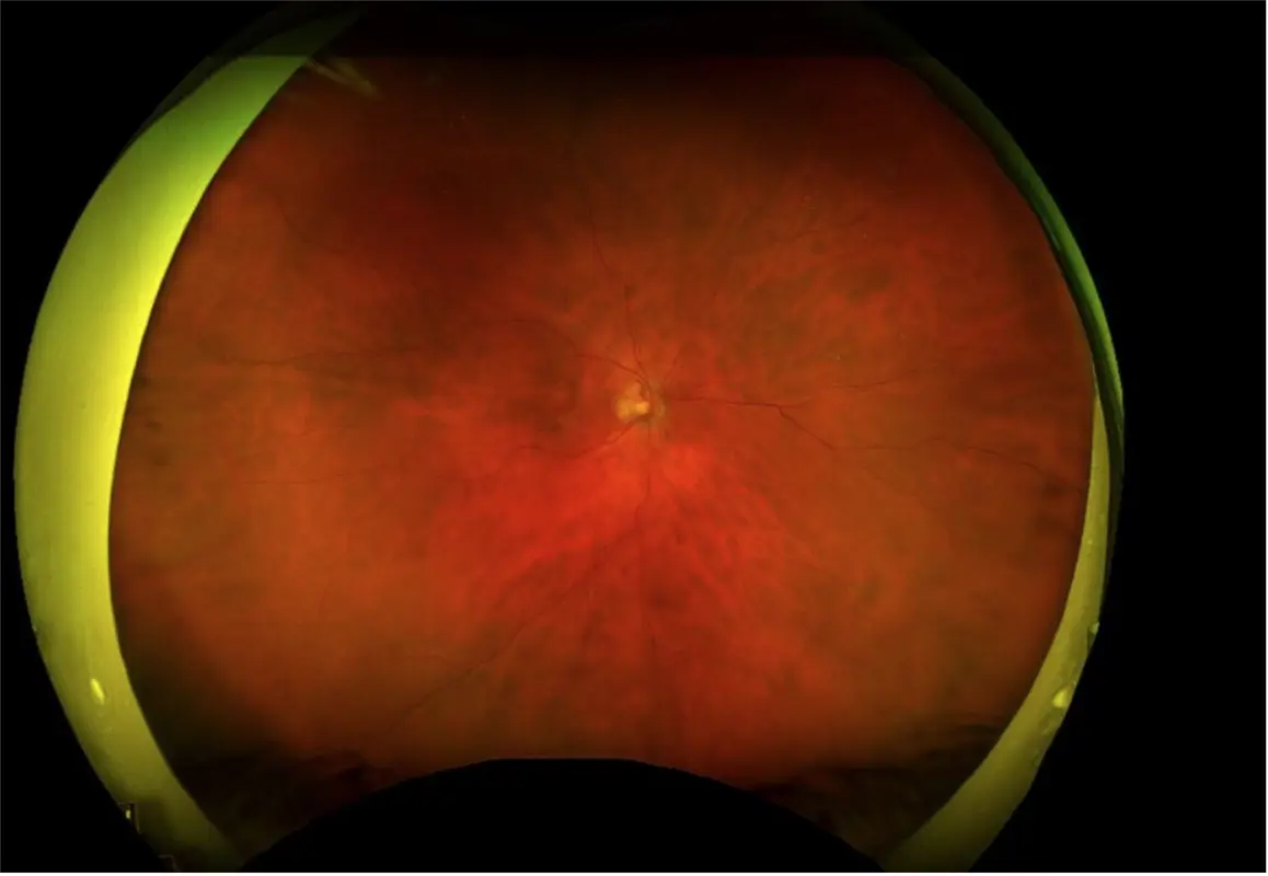 Example fundus image