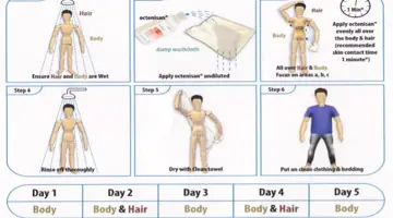 Instructions we take during MRSA Decolonisation