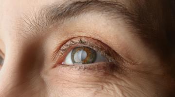 A fragment of a woman's face with an eye