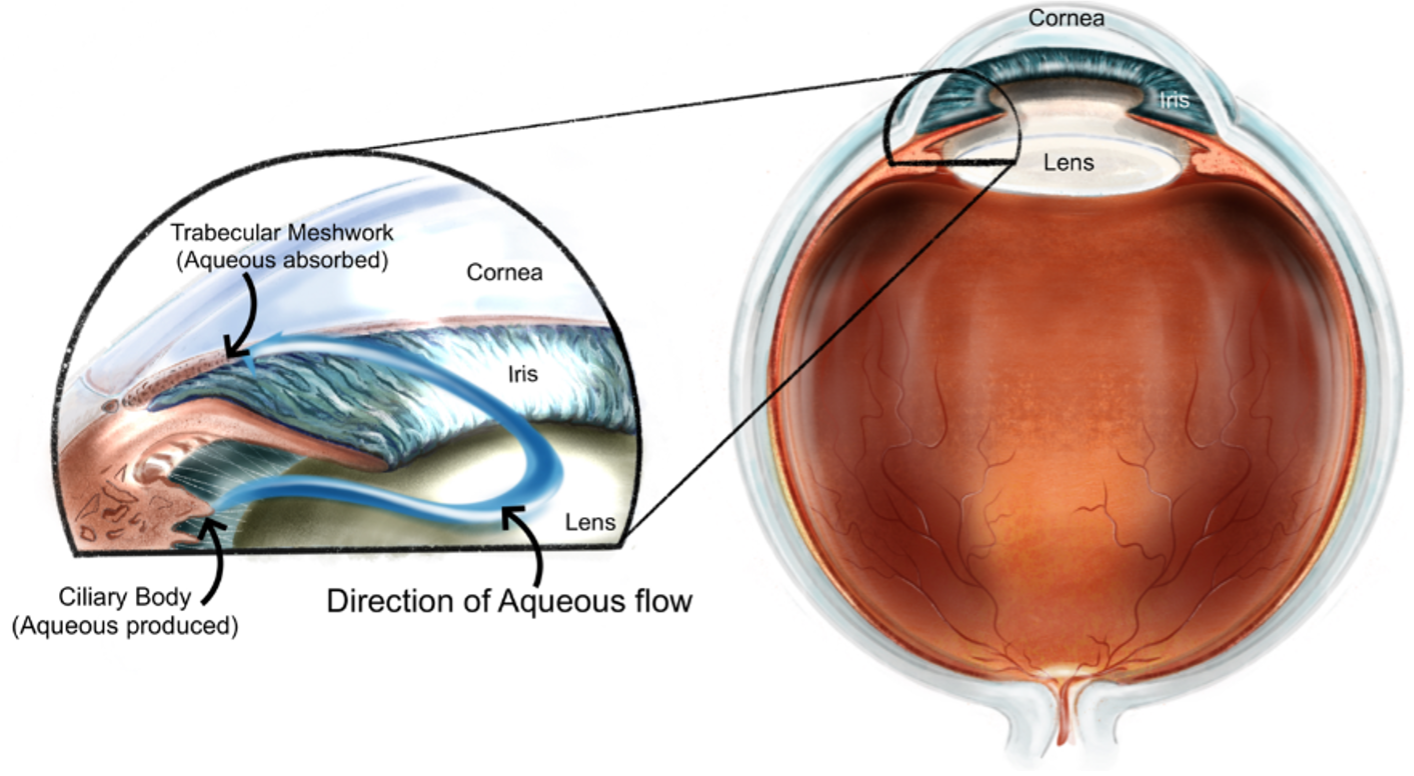 Diagram of Selective Laser Trabeculoplasty